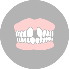 歯と歯の間に隙間が空いているすきっ歯